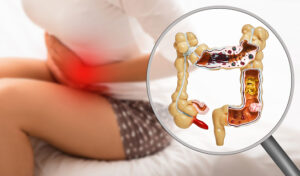 Read more about the article 12 Powerful Home Remedies for Flatulence