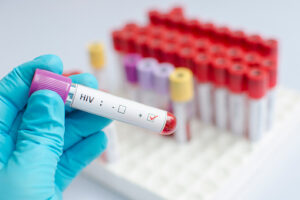 Read more about the article New HIV Treatment In South Africa